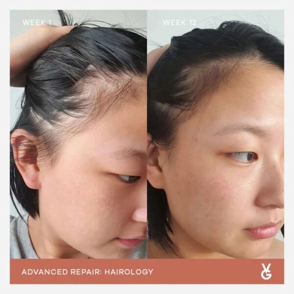 Vida Glow Hairology Advanced Repair | 30 Capsules