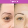 Vida Glow Liquid Collagen 12-Week Consumer Study Vida Glow Liquid Collagen Skin Health 12-week consumer study showing TruSkin age results