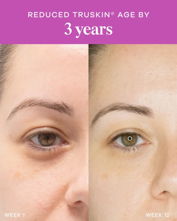 Vida Glow Liquid Collagen 12-Week Consumer Study Vida Glow Liquid Collagen Skin Health 12-week consumer study showing TruSkin age results