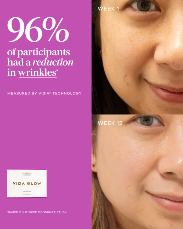 Vida Glow Liquid Collagen Wrinkle Consumer Study Vida Glow Liquid Collagen Skin Health 12-week consumer study on the appearance of wrinkles